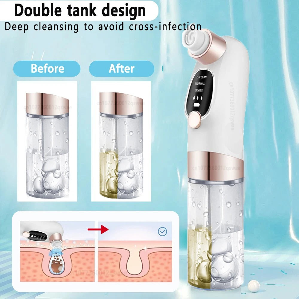 Blackhead Remover Vacuum Tool | Negative Pressure, 6 Interchangeable Heads | Dual Tank Pore Cleanser with LED Display