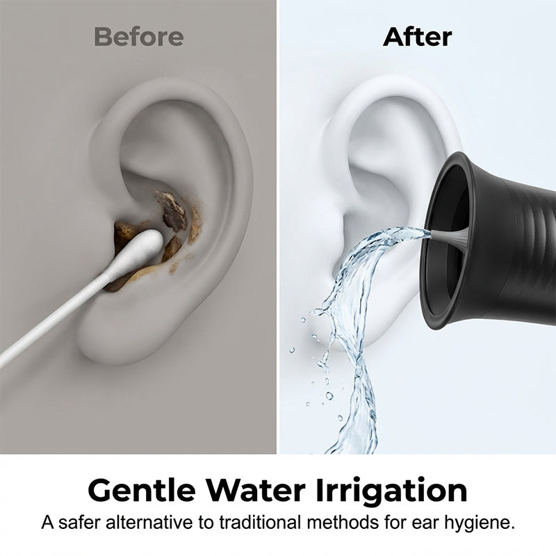 Ear Wax Removal Irrigator | Dual-Tank System with Adjustable Nozzles | Rechargeable USB-C Battery for Travel-Ready Hygiene