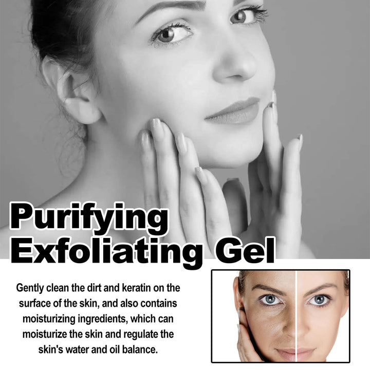 Exfoliating Gel for Women | Vitamin C, Sodium Hyaluronate &amp; Cherry Blossom | Smooths Rough Skin, Fades Dark Patches in 1 Minute