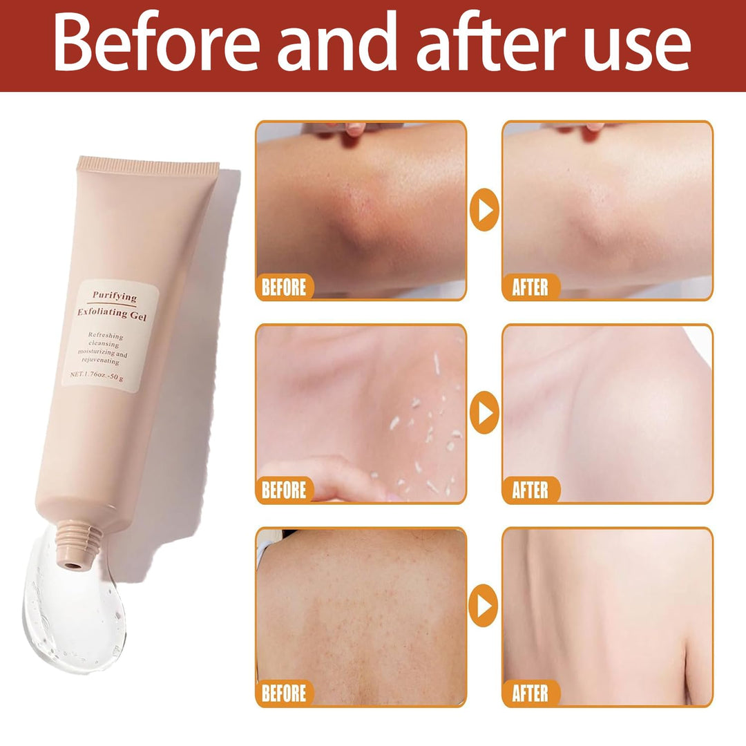 Exfoliating Gel for Women | Vitamin C, Sodium Hyaluronate &amp; Cherry Blossom | Smooths Rough Skin, Fades Dark Patches in 1 Minute