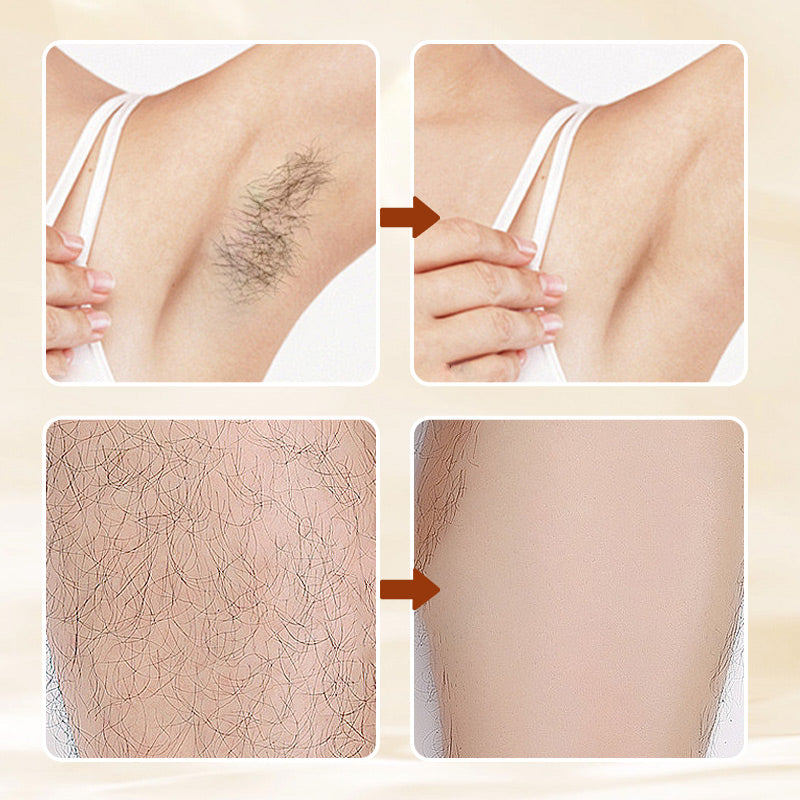 Hair Removal Cream for Women | 100 ml, Sensitive Skin Formula | Smooth, Irritation-Free Results in Minutes, No Shaving
