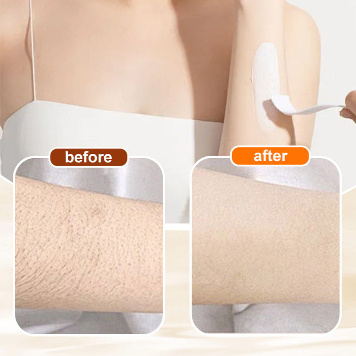 Hair Removal Cream for Women | 100 ml, Sensitive Skin Formula | Smooth, Irritation-Free Results in Minutes, No Shaving