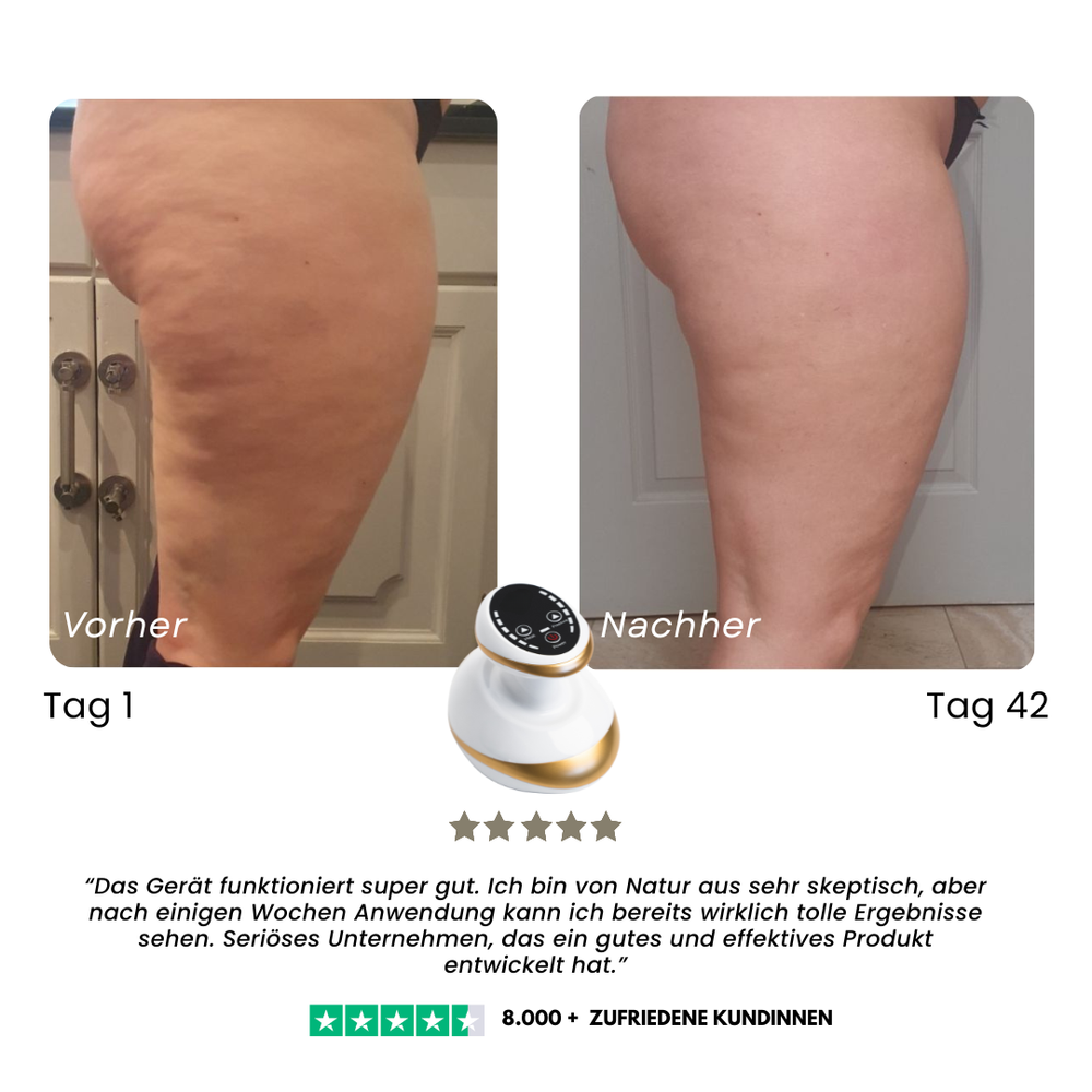 Heated Body Massager | Heat & Deep Kneading Vibration Massage | Smooths and Tones Thighs, Hips, Stomach and Arms
