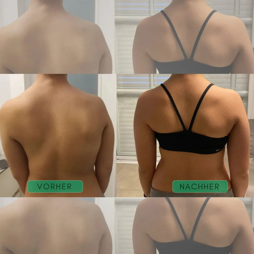 Posture Corrector Back Brace | Adjustable Straps Support Shoulders & Upper Back | Discreet Under Clothing Design