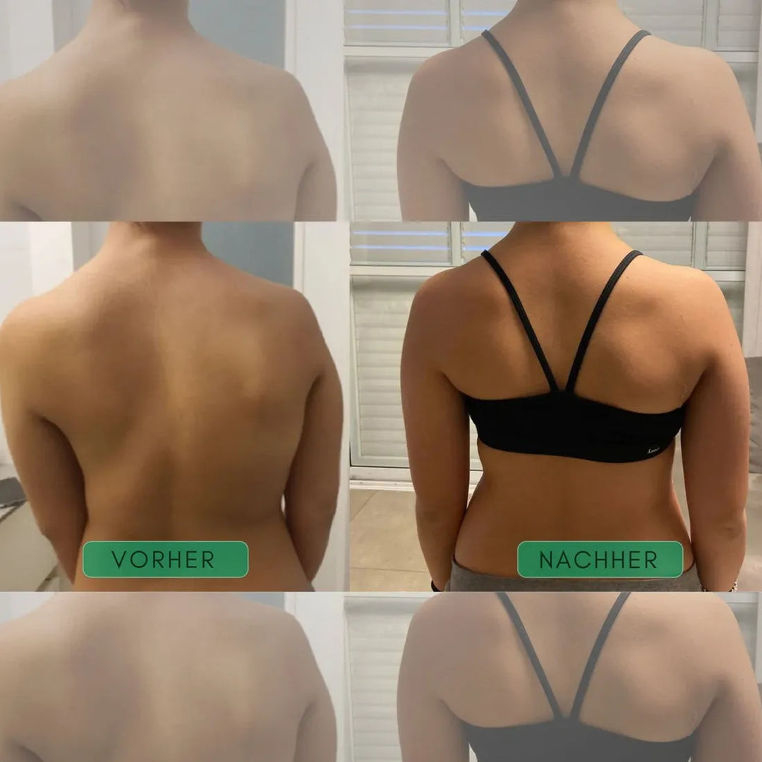 Posture Corrector Back Brace | Adjustable Straps Support Shoulders &amp; Upper Back | Discreet Under Clothing Design