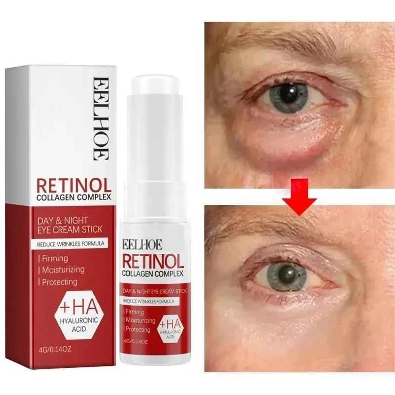 Under-Eye Cream for Women | Korean Beauty Formula | Reduces Puffiness, Dark Circles, Fine Lines and Lifts Skin