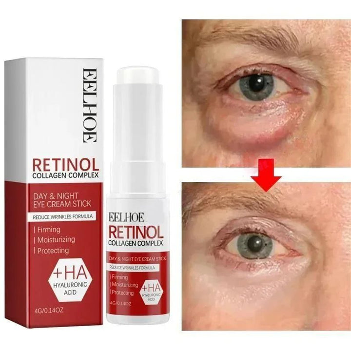 Under-Eye Cream for Women | Korean Beauty Formula | Reduces Puffiness, Dark Circles, Fine Lines and Lifts Skin